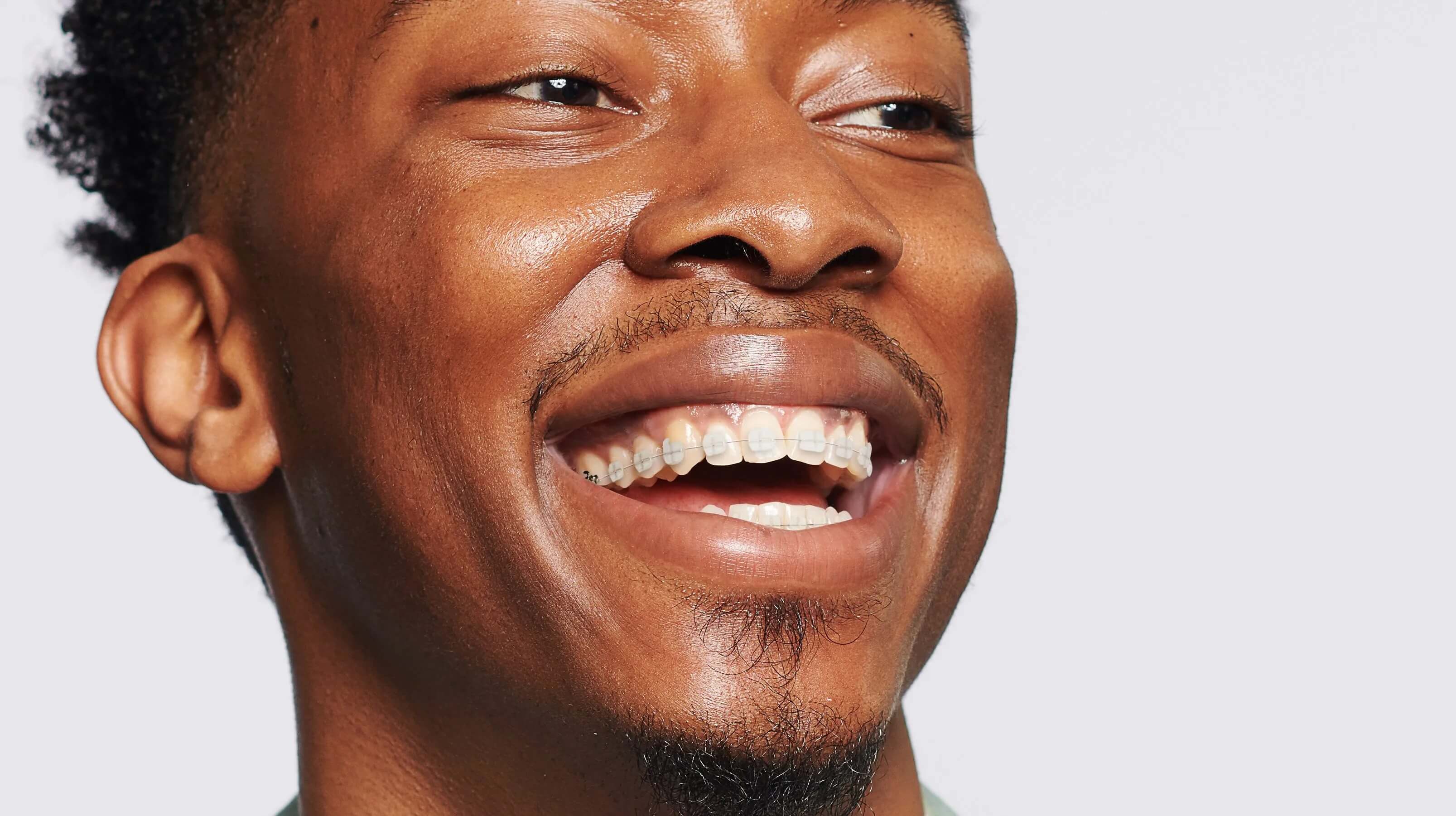 Seattle Orthodontist - LightForce Braces - Inspired Orthodontics ...