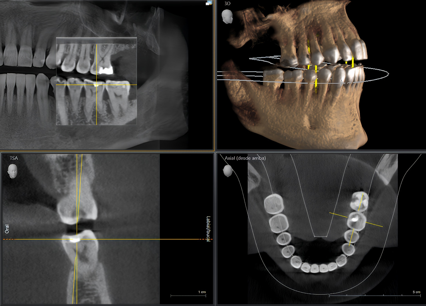 CBCT imaging