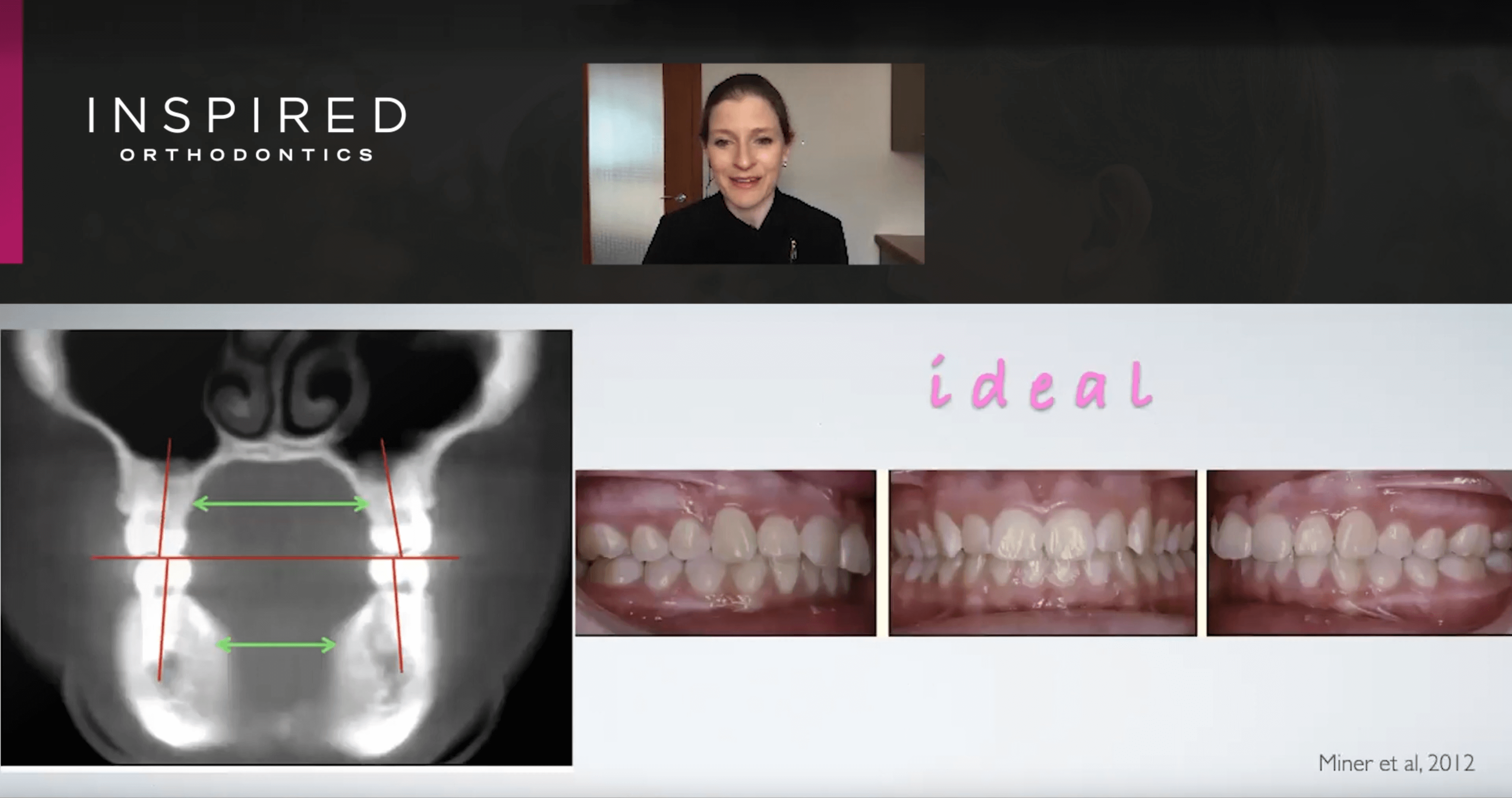 Considering Dental Arch Shape
