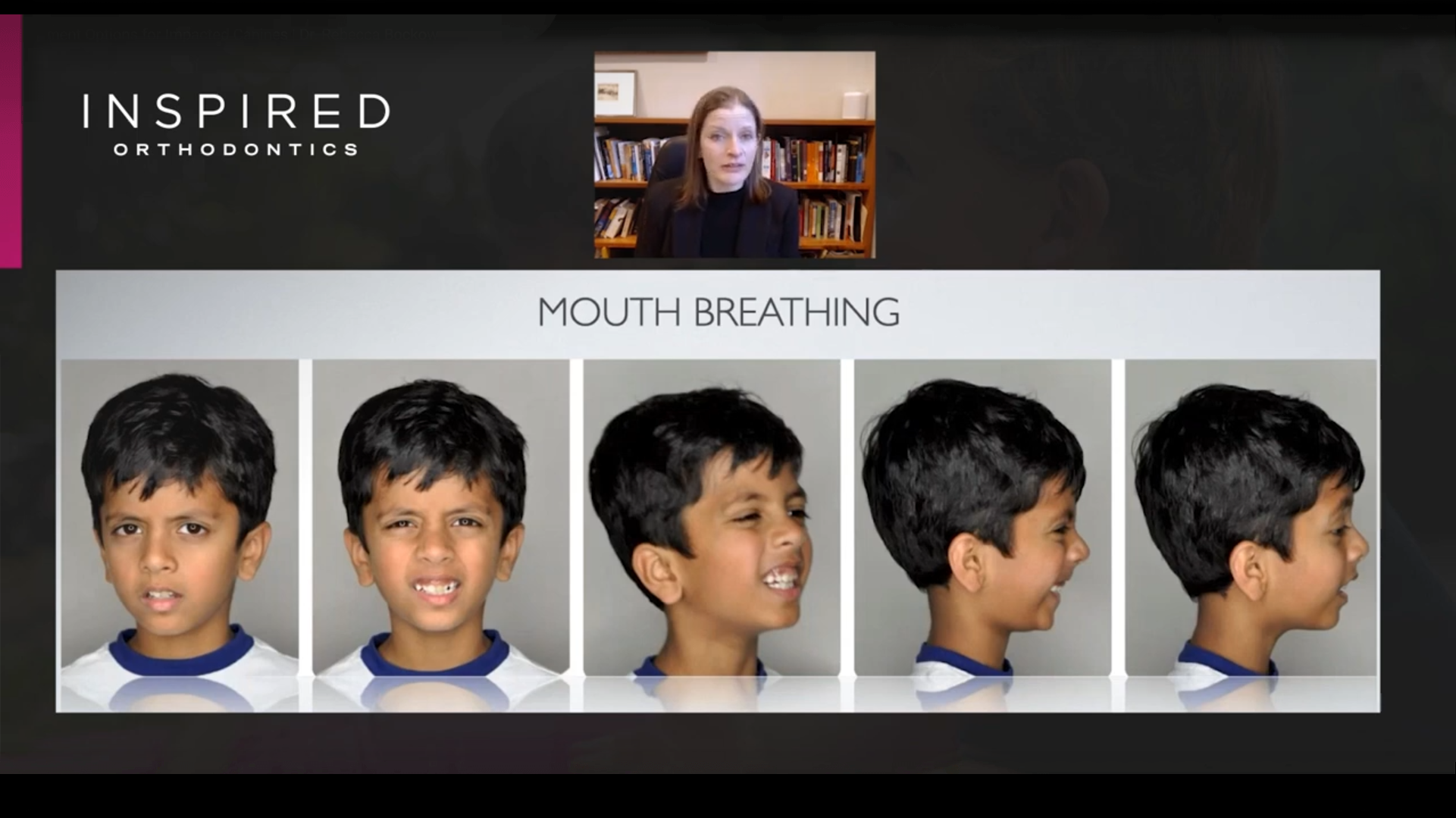 Sleep-Disordered Breathing in Children