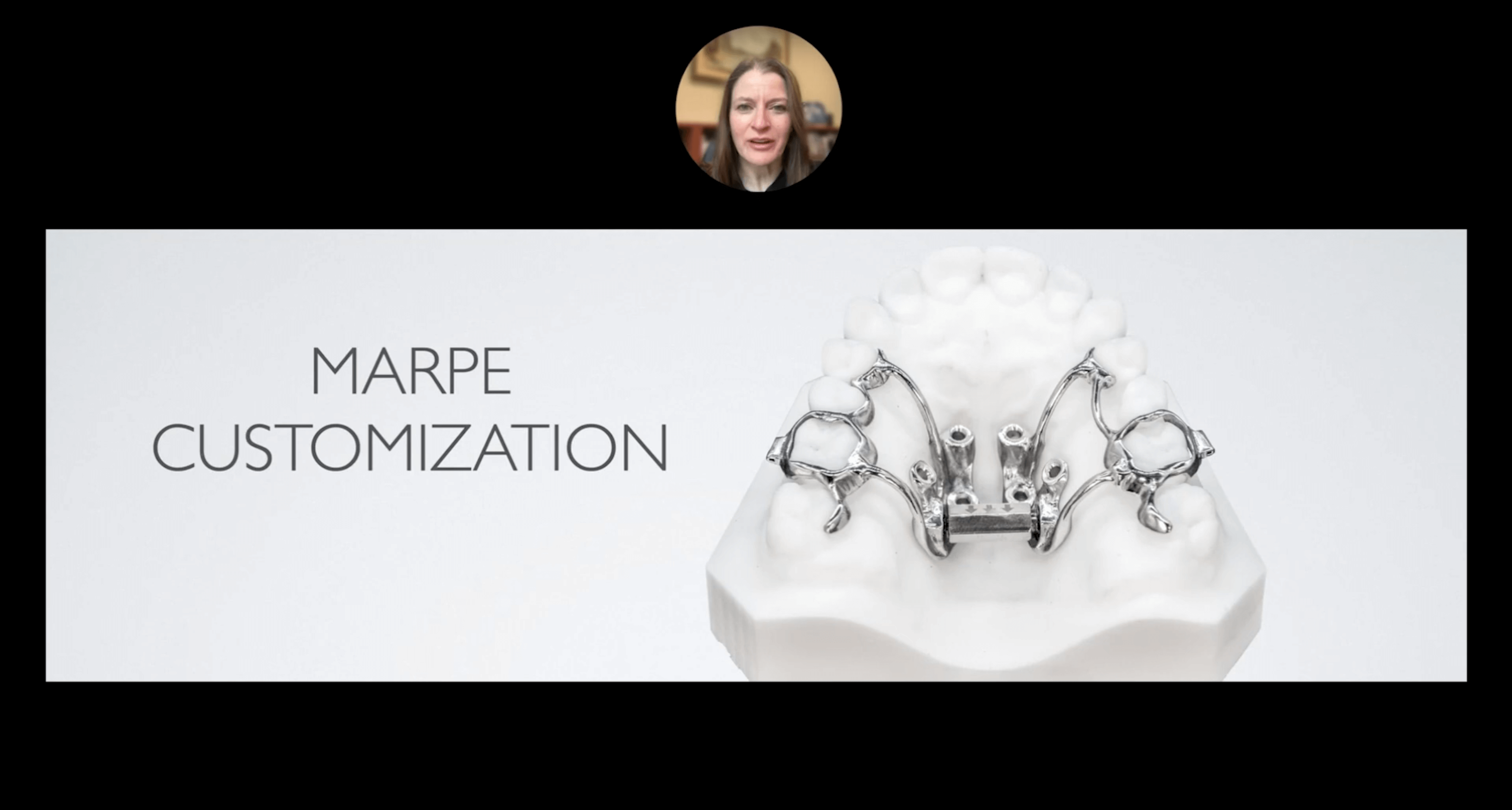 Non-Surgical Expansion with Custom TAD Expanders
