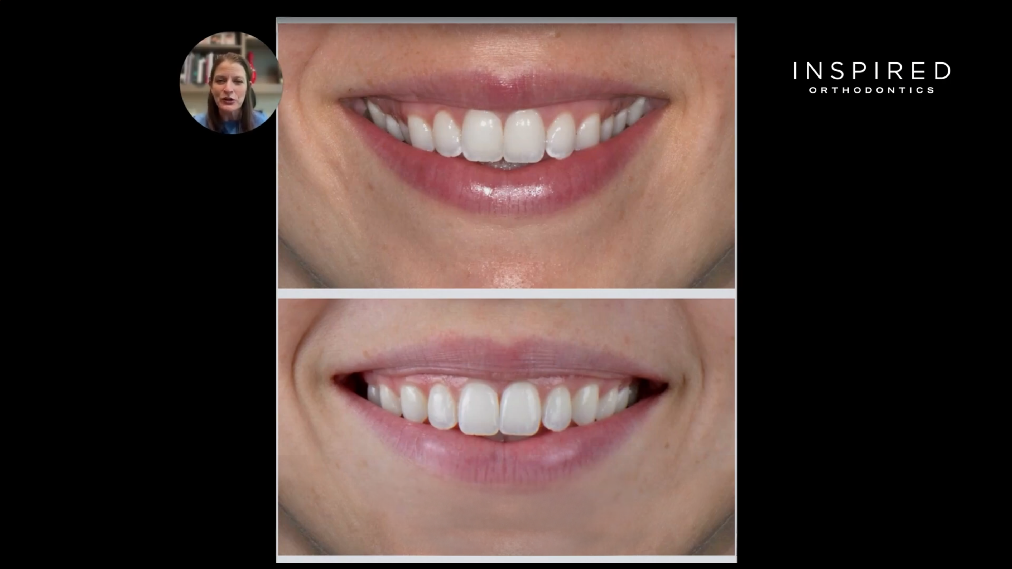 Innovative Orthodontic Case Study