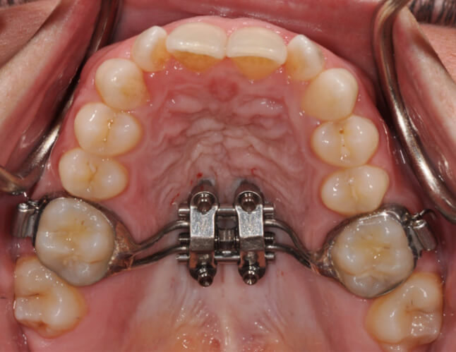 Image Description Here