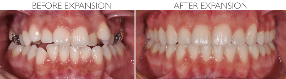 Image Description Here