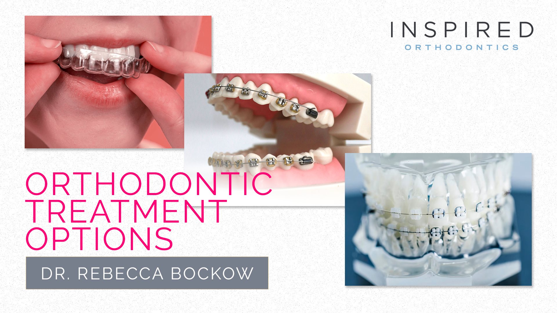 Orthodontic Treatment Options