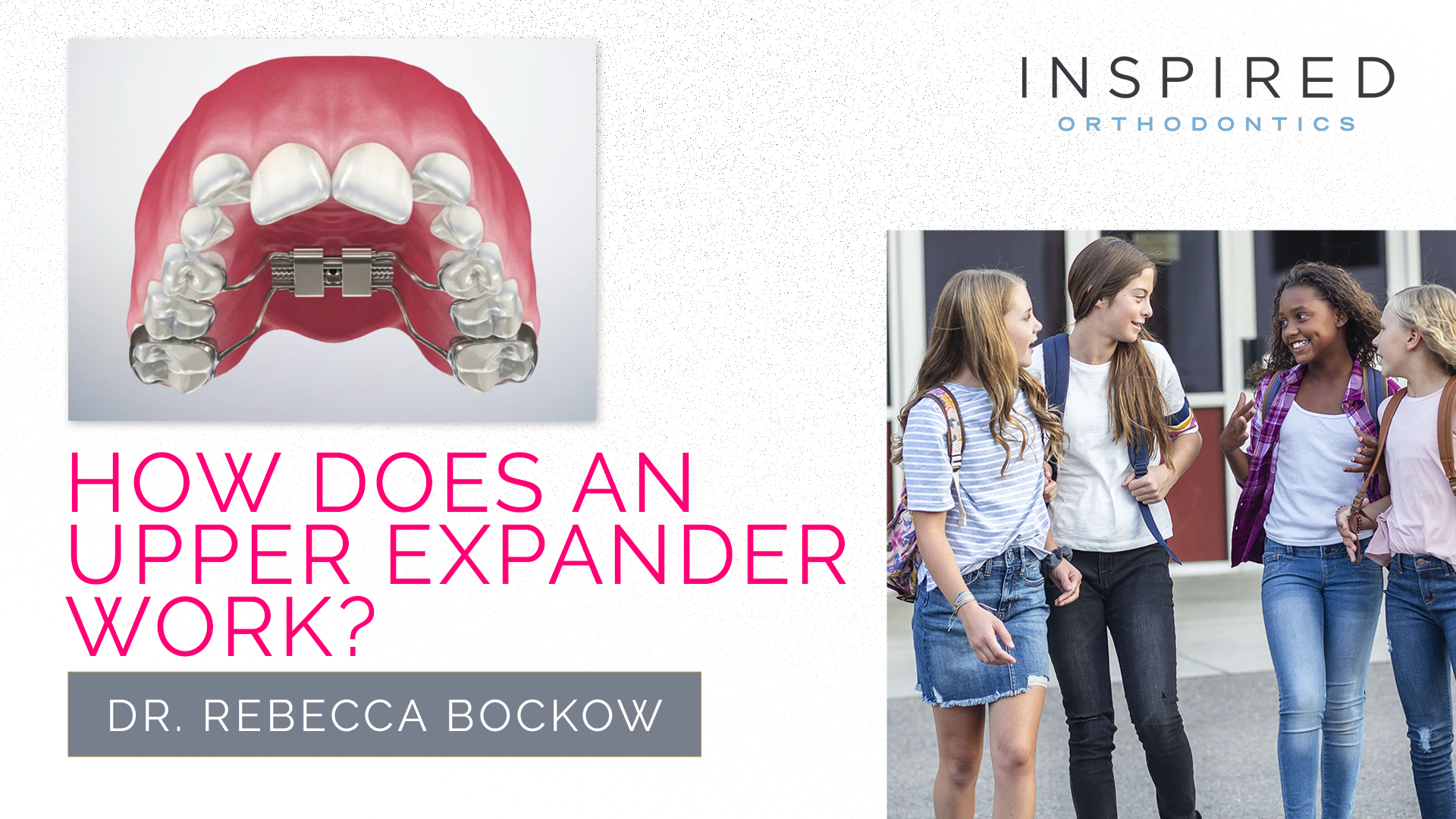 How Does an Upper Expander Work?